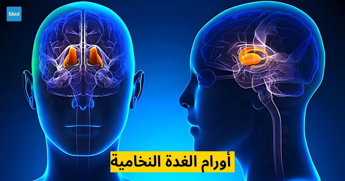 أورام الغدة النخامية